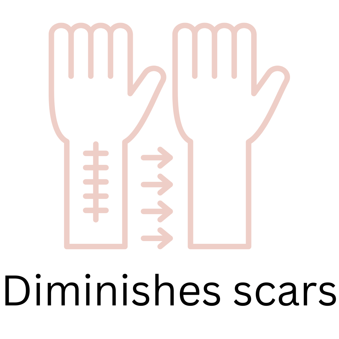 Microneedling can diminish scars